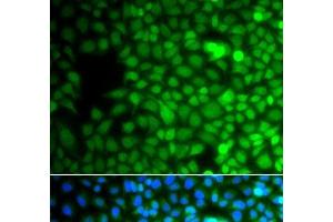 Immunofluorescence analysis of A549 cells using ZNF195 Polyclonal Antibody (ZNF195 抗体)