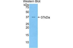 Western Blotting (WB) image for anti-Preferentially Expressed Antigen in Melanoma (PRAME) (AA 416-502) antibody (ABIN3203008) (PRAME 抗体  (AA 416-502))