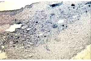 Immunohistochemistry (IHC) image for anti-Signal Transducer and Activator of Transcription 3 (Acute-Phase Response Factor) (STAT3) (C-Term) antibody (ABIN184593)