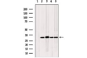 Western blot analysis of extracts from various samples, using TPI1 antibody. (TPI1 抗体  (C-Term))