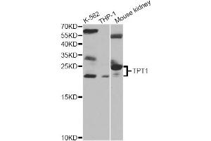 Western blot analysis of extracts of various cell lines, using TPT1 antibody. (TPT1 抗体)