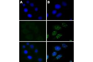ATM phospho Ser1981 antibody (Clone 10H11.
