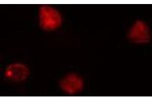 ABIN6276822 staining HeLa cells by IF/ICC. (CDK7 抗体  (Internal Region))