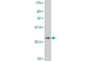 Western Blot detection against Immunogen (35. (IRX3 抗体  (AA 123-209))