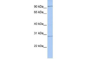 HMX2 antibody used at 0. (HMX2 抗体  (Middle Region))