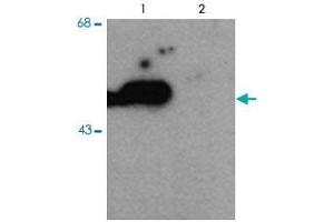 Western blot of HEK293 cells transfected with PARK2 WT (Phospho) and PARK2 S101 mutant (non-phospho) showing the phospho-specific immunolabeling of the ~ 52 k parkin protein. (Parkin 抗体  (pSer101))