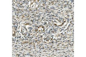 IHC analysis of SGK1 using anti-SGK1 antibody (ABIN7603118).