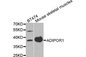 Western blot analysis of extracts of various cell lines, using ADIPOR1 antibody (ABIN5970705) at 1/1000 dilution. (Adiponectin Receptor 1 抗体)