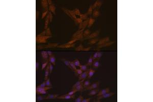 Immunofluorescence analysis of NIH-3T3 cells using KIFC1 Rabbit mAb (ABIN1680485, ABIN3015039, ABIN3015040 and ABIN7101305) at dilution of 1:100 (40x lens). (KIFC1 抗体)