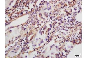 Immunohistochemistry (IHC) image for anti-C-Type Lectin Domain Family 5, Member A (CLEC5A) (AA 101-190) antibody (ABIN748763)