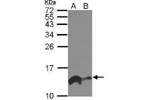 WB Image Sample (30 ug of whole cell lysate) A: A549 B: HeLa 15% SDS PAGE antibody diluted at 1:1000 (IFITM1 抗体)