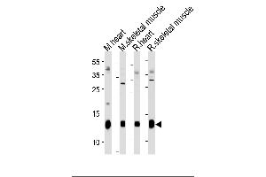 PLM Antibody (E1) (ABIN1882173 and ABIN2844827) western blot analysis in mouse heart,skeletal muscle and rat heart,skeletal muscle tissue lysates (35 μg/lane). (FXYD1 抗体  (N-Term))