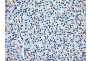 Immunohistochemical staining of paraffin-embedded Human colon tissue using anti-H6PD mouse monoclonal antibody. (Glucose-6-Phosphate Dehydrogenase 抗体)