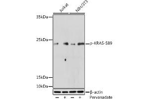 Western blot analysis of extracts of various cell lines, using Phospho-KRAS-S89 Rabbit pAb (ABIN7267530) at 1:500 dilution. (K-RAS 抗体  (pSer89))