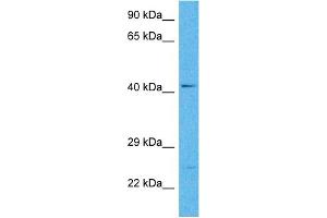Host:  Rabbit  Target Name:  SLC14A1  Sample Tissue:  Human Hela Whole Cell  Antibody Dilution:  1ug/ml (SLC14A1 抗体  (C-Term))