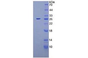 SDS-PAGE analysis of Rat XPC Protein. (XPC 蛋白)
