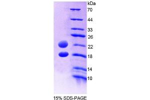 SDS-PAGE analysis of Human AVPI1 Protein. (AVPI1 蛋白)