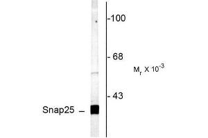 Image no. 1 for anti-Synaptosomal-Associated Protein, 25kDa (SNAP25) (C-Term) antibody (ABIN372714)