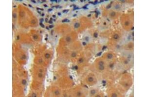 Used in DAB staining on fromalin fixed paraffin- embedded liver tissue (CDNF 抗体  (AA 33-187))