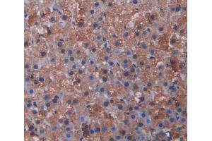Used in DAB staining on fromalin fixed paraffin- embedded kidney tissue (CYP17A1 抗体  (AA 201-507))