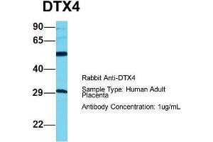 Host: Rabbit  Target Name: DTX4  Sample Tissue: Human Adult Placenta  Antibody Dilution: 1. (Deltex Homolog 4 抗体  (C-Term))