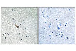 Immunohistochemistry (IHC) image for anti-Amyloid beta (A4) Precursor-Like Protein 2 (APLP2) (pTyr755) antibody (ABIN5976088) (APLP2 抗体  (pTyr755))