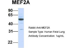 Host:  Rabbit  Target Name:  MEF2A  Sample Type:  Human Fetal Lung  Antibody Dilution:  1. (MEF2A 抗体  (Middle Region))