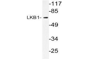 Western blot (WB) analyzes of LKB1 antibody in extracts from CV-1cells. (LKB1 抗体)
