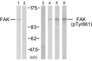 Western blot analysis using FAK (Ab-861) antibody (E021076, Lane 1 and 2) and FAK (phospho-Tyr861) antibody (E011059, Lane 3, 4, 5 and 6). (FAK 抗体)