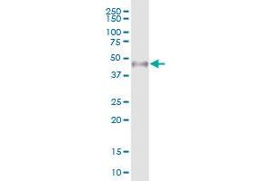 WTIP MaxPab polyclonal antibody. (WTIP 抗体  (AA 1-430))