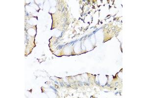 Immunohistochemistry of paraffin-embedded human colon using NRG4 antibody (ABIN1873958) at dilution of 1:100 (40x lens). (Neuregulin 4 抗体)