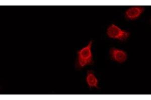 ABIN6276057 staining HeLa by IF/ICC. (GPROPDR 抗体)