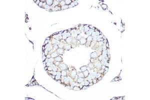 Immunohistochemistry of paraffin-embedded rat testis using SSTR5 Rabbit mAb (ABIN7270495) at dilution of 1:100 (40x lens). (SSTR5 抗体)