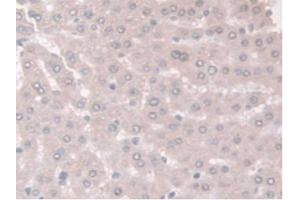 IHC-P analysis of Rat Liver Tissue, with DAB staining. (Adiponectin Receptor 2 抗体  (AA 1-147))