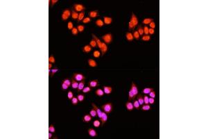 Immunofluorescence analysis of Hela cells using ZNF408 antibody  at dilution of 1:100 (40x lens). (ZNF408 抗体  (AA 1-240))