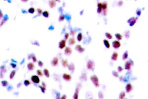 Image no. 2 for anti-Collagen, Type XVIII, alpha 1 (COL18A1) (Chain alpha 1) antibody (ABIN265401) (COL18A1 抗体  (Chain alpha 1))