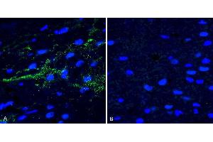 Immunohistochemistry analysis using Rabbit Anti-Alpha Synuclein (pSer129) Polyclonal Antibody (ABIN5650937). (SNCA 抗体  (pSer129) (APC))
