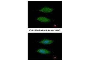 ICC/IF Image Immunofluorescence analysis of methanol-fixed HeLa, using LOC283129, antibody at 1:200 dilution. (C11orf85 抗体  (Center))
