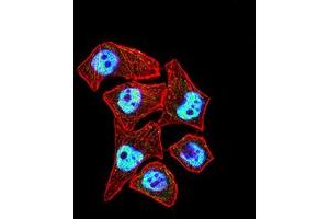 Immunofluorescence (IF) image for anti-Catenin, beta Like 1 (CTNNBL1) (AA 390-557) antibody (ABIN7193357)