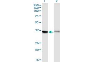 Western Blot analysis of GPR84 expression in transfected 293T cell line by GPR84 monoclonal antibody (M03), clone 1D9. (GPR84 抗体  (AA 208-316))