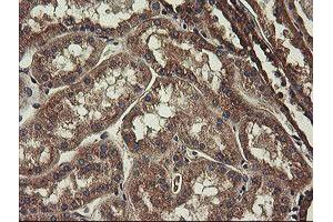 Image no. 19 for anti-Ubiquitin-Conjugating Enzyme E2, J1, U (UBE2J1) antibody (ABIN1501638)