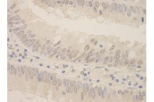 anti-SFRS Protein Kinase 2 (SRPK2) (AA 425-475) antibody