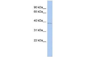 PNMA1 antibody used at 1 ug/ml to detect target protein. (PNMA1 抗体  (Middle Region))