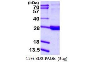 SDS-PAGE (SDS) image for Retinol Binding Protein 1, Cellular (RBP1) (AA 1-197) protein (His tag) (ABIN7279628)