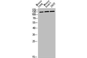 Western blot analysis of mouse-lung mouse-heart 293T lysis using CEP135 antibody. (CEP135 抗体  (C-Term))