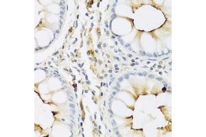 Immunohistochemistry of paraffin-embedded human colon using RN antibody (ABIN3015630, ABIN3015631, ABIN3015632 and ABIN6218985) at dilution of 1:100 (40x lens). (RNASE3 抗体  (AA 28-160))