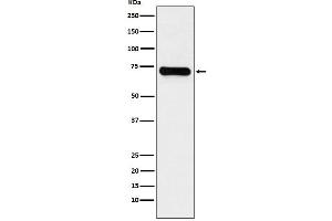 Western blot analysis of LysRS expression in Jurkat cell lysate.