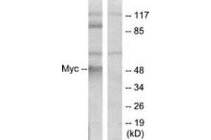 Western blot analysis of extracts from ovary cancer cells, using MYC (Ab-58) Antibody. (c-MYC 抗体  (AA 25-74))