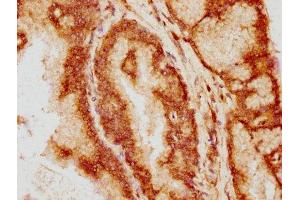 IHC image of ABIN7145150 diluted at 1:200 and staining in paraffin-embedded human prostate tissue performed on a Leica BondTM system. (BCL9 抗体  (AA 231-340))
