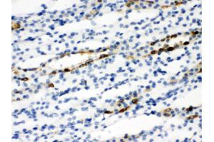 Anti-SLC9A2 antibody, IHC(P) IHC(P): Rat Kidney Tissue (SLC9A2 抗体  (C-Term))
